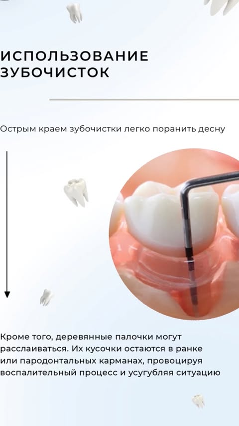Протезирование